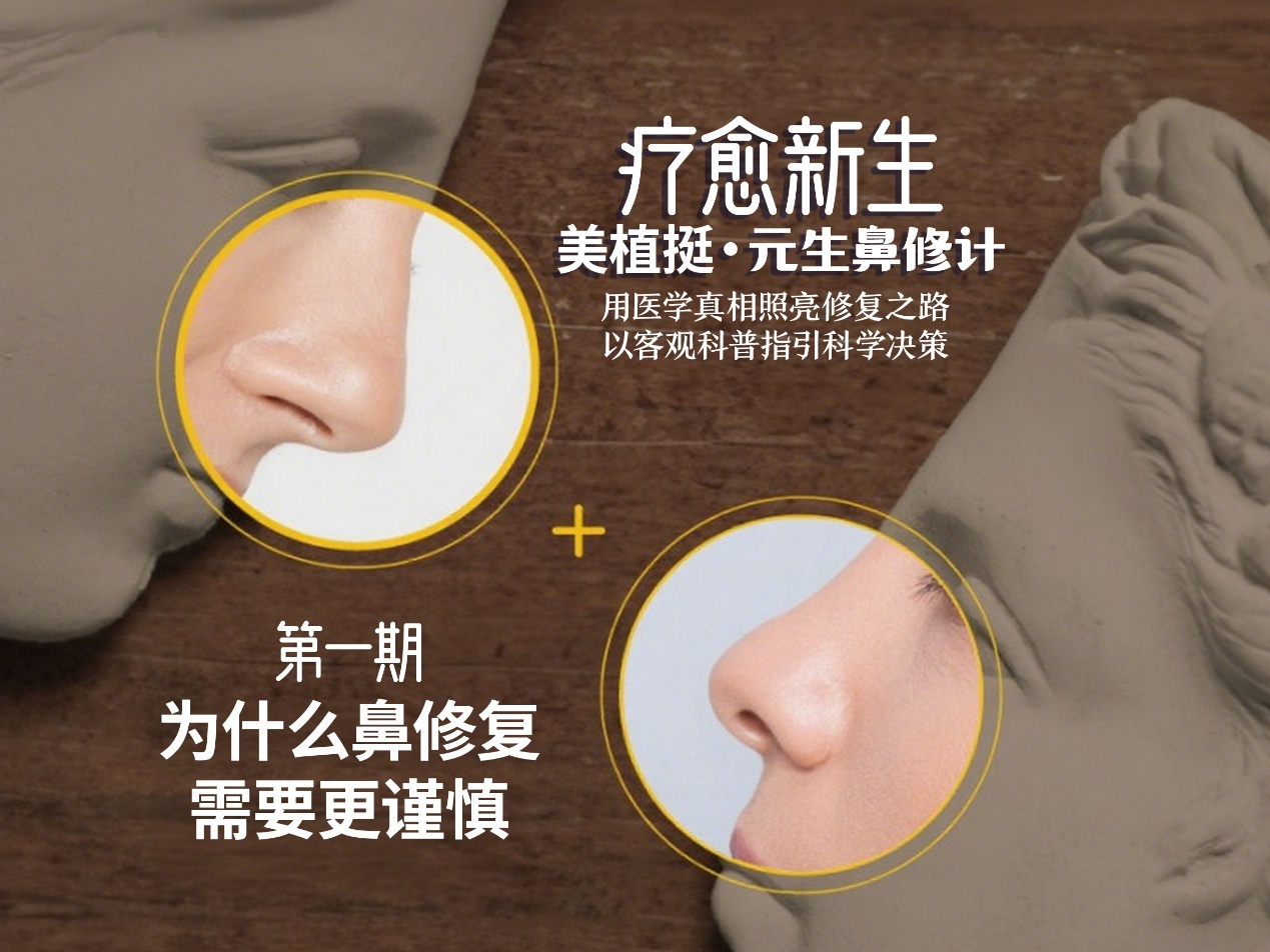 美植挺元生鼻修计(第一期)鼻修复为什么需要更谨慎？